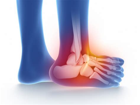 Ankle Pain Causes Symptoms And Effective Treatment Options