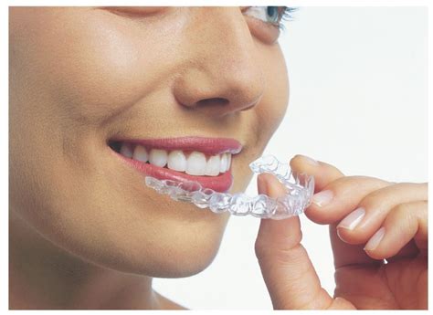 How Long Does Invisalign Take Invisalign Wichita Derby Invisalign