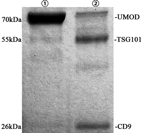 SDS PAGE results of marker proteins in exosomes of serum ① before