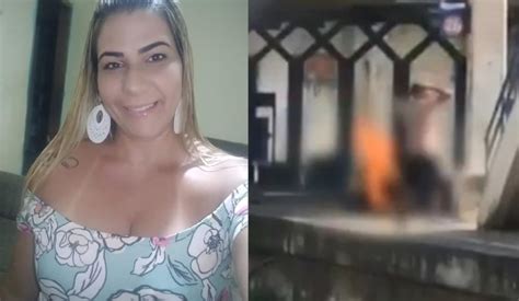 Morre mulher que teve corpo incendiado ex marido é acusado de crime