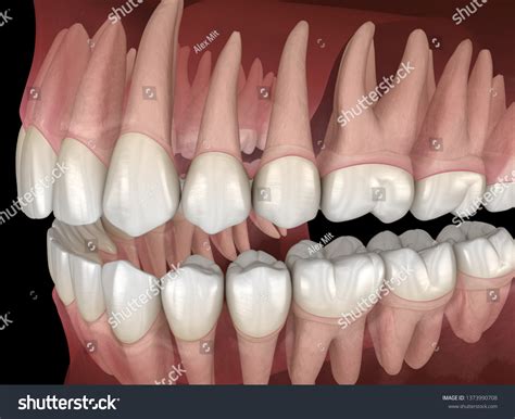 Morphology Mandibular Maxillary Human Gum Teeth Stock Illustration