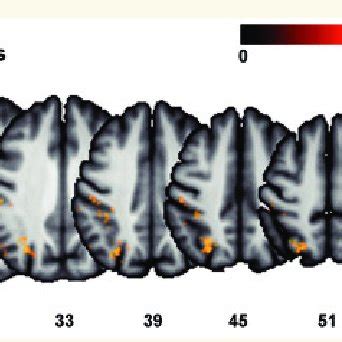 Vlsm Map For The Combined Score For Imitation Of Hand And Finger