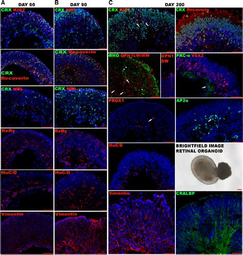 Deconstructing Retinal Organoids Single Cell Rna‐seq Reveals The Cellular Components Of Human