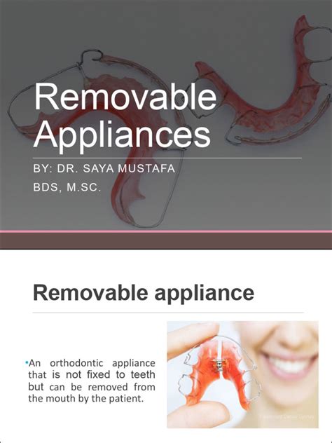 Lect 17 Removable Appliances Part 1 Pdf