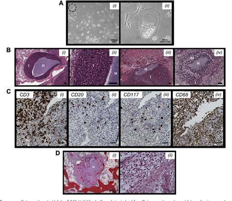 Figure 1 from Acute inflammation with induction of anaphylatoxin C5a and terminal complement ...