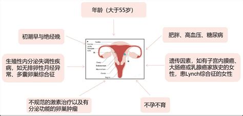 科普 全面认识子宫内膜癌 学术报道 武汉艾米森生命科技有限公司