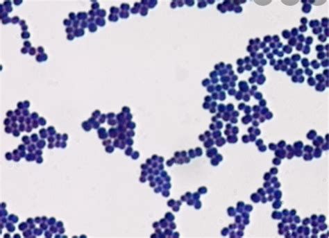 MLT141 Gram Stain Lab Practical Flashcards Quizlet