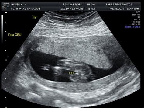 16 week ultrasound! boy or girl? | BabyCenter