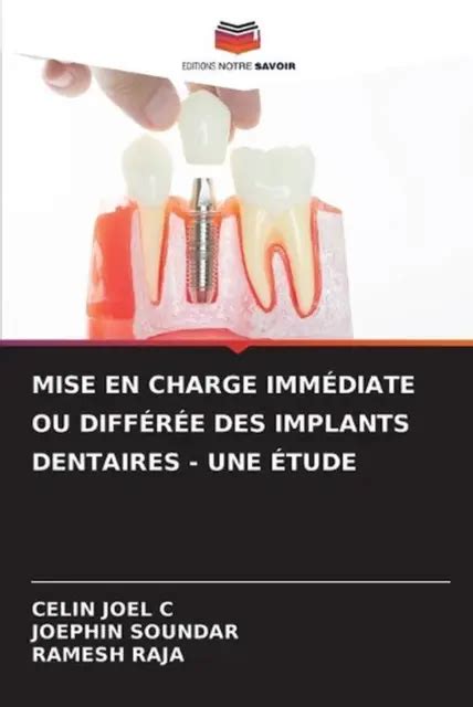 Mise En Charge Immdiate Ou Diffre Des Implants Dentaires Une Tude By