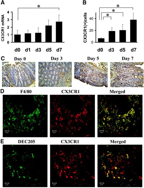 Intracolonic Infiltration Of CX3CR1 Express Ing Cells In DSS Induced