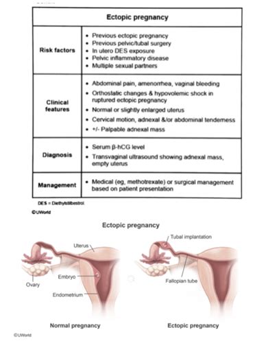 Ectopic Molar Pregnancy Flashcards Quizlet