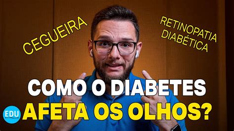 Como Diabetes Afeta Os Olhos Retinopatia Diab Tica Edu Diabetes