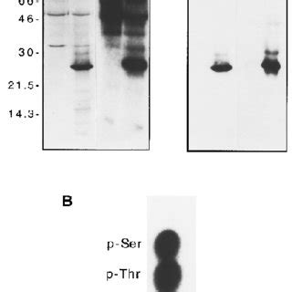 Expression And Phosphorylation Of Vif In Vivo A HeLa Cells Were