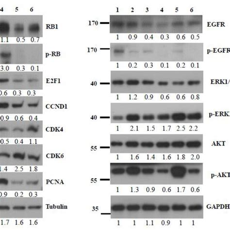 Western Blot Analysis Of Key Protein Molecules Of Egfr And Cell Cycle