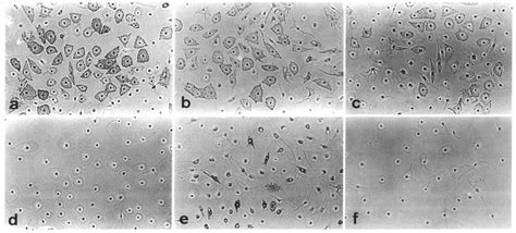 Melanocytes In Pure Culture Of Epidermal Cell Suspensions From Various