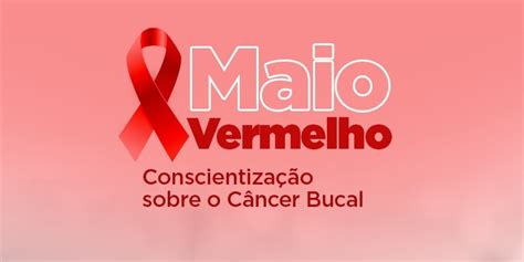 Maio Vermelho Conscientiza Sobre O Câncer Bucal Oncológica Do Brasil