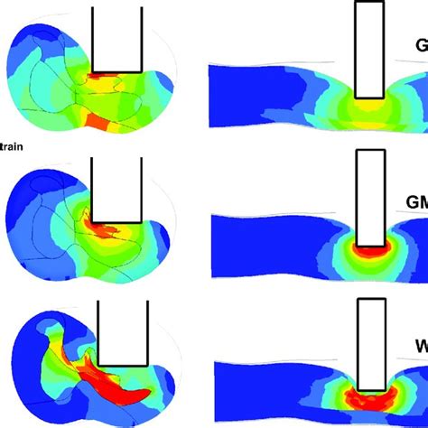 Comparison Of Strain Distribution Maximal Principal Strains Throughout