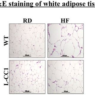 Histological Analysis Of White Adipose Tissue White Adipose Tissue