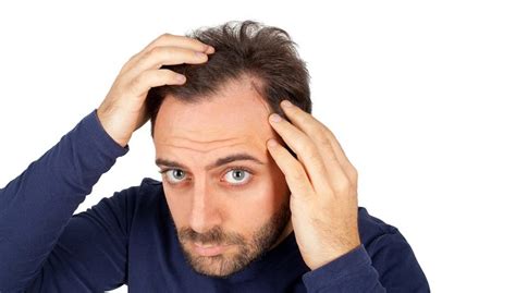 Men S Hair Loss Solutions Try These 5 Natural Remedies To Cure Baldness Lyfboat