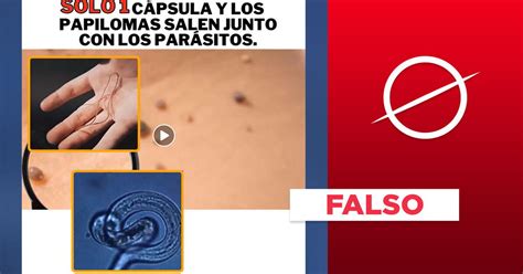 Es Falso Que Verrugas Del Virus Del Papiloma Humano Se Curan Con Productos Antiparasitarios