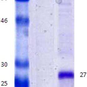 SDS PAGE Analysis Of Enterotoxin On A 10 Polyacrylamide Gel Lane 1