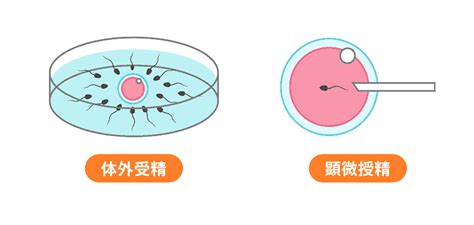 体外受精•顕微授精について│【医師監修】ジネコ不妊治療情報