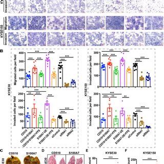 Upregulated S100A7 Promotes Tumorassociated Macrophage Infiltration