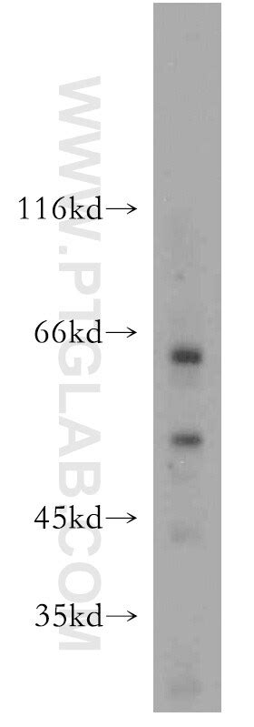 Perforin Antibody (14580-1-AP)