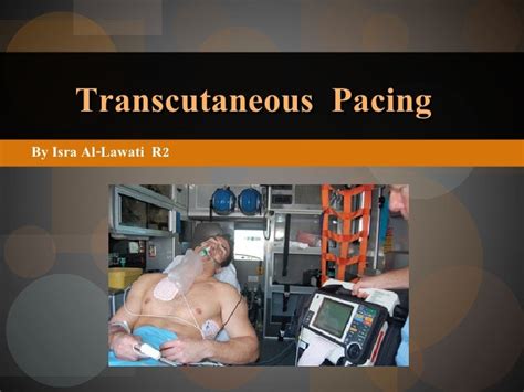 Transcutaneous Pacing