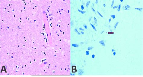 Histological findings. (2A) Histological examination of brain... | Download Scientific Diagram