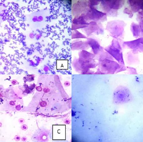 Canine Vaginal Cytology