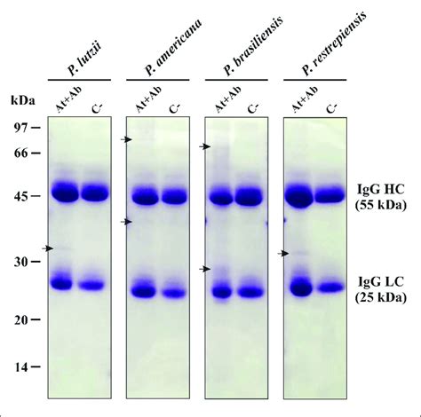 Electrophoretic Profile Of Affinity Chromatography One Dimensional