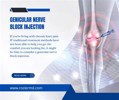 Genicular Nerve Block Injection Benefits And Treatment Mansfield Tx