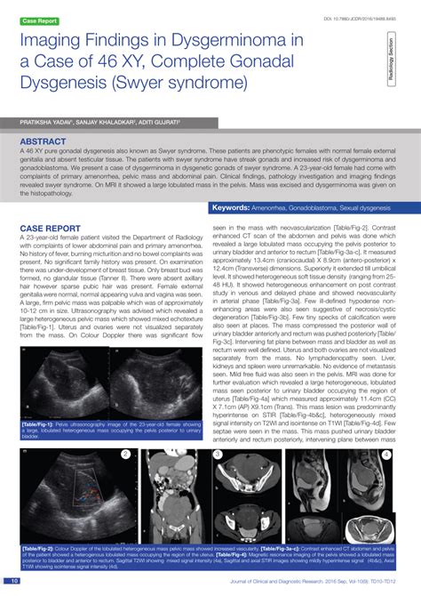 Gonadal Dysgenesis Ultrasound