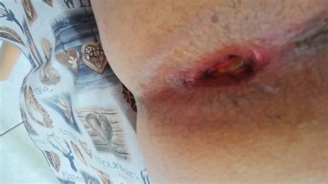 Big Assed Asian Dildo Ass Fucked By BF Porn 88 XHamster XHamster