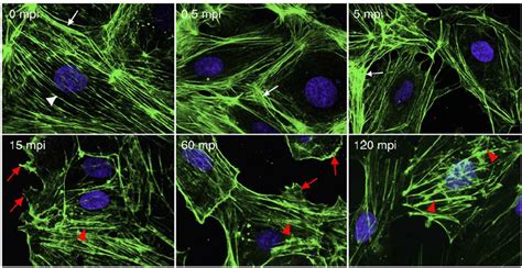 Kshv Infection Of Endothelial Cells Induces Actin Dynamics And