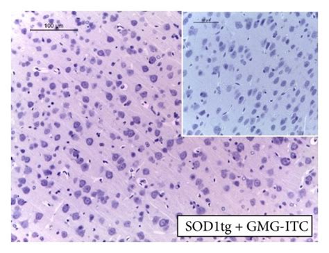 Inos Formation And Mmp 9 Expression Immunohistochemical Ihc