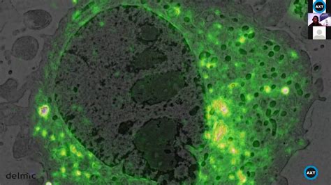 Introduction To In Situ Correlative Light And Electron Microscopy Clem