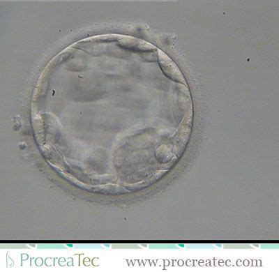 Pin on Beautiful BLASTOCYSTS!