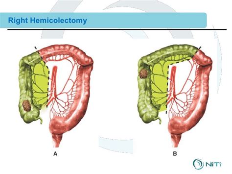 Combined 12 Clinical Training Surgical Procedures