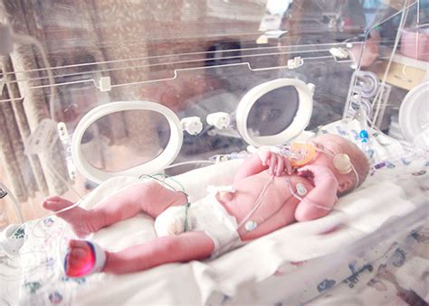 Apa Itu Nicu Ruangan Perawatan Bayi Neonatal Er Indonesia