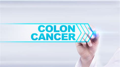 Colon Cancer Screenings What You Should Know