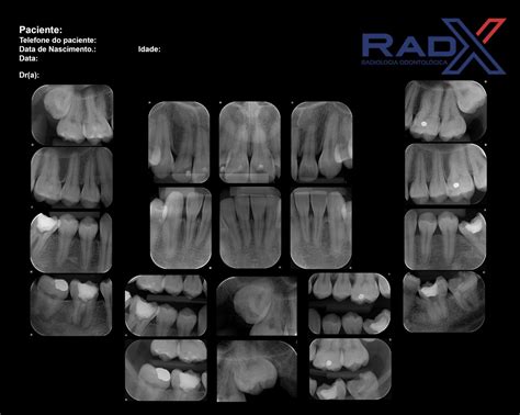 Quanto custa a Radiografia Periapical Completo Guia de Preços