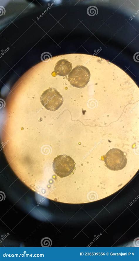Microscopic View Of Germinating Pollen Grains Stock Photo Image Of