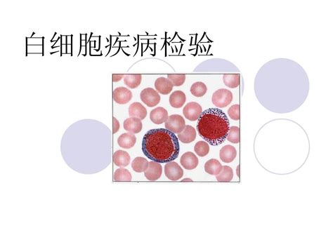 08级急性白血病1word文档在线阅读与下载无忧文档