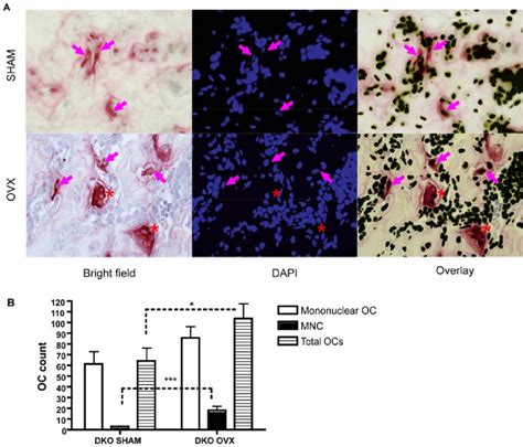 Increased Osteoclast Formation In Vivo In Dap Fcrc Ovx Group A