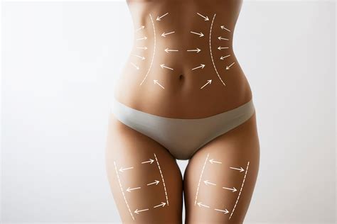 Tips To Maintain Liposuction Results Elements Toronto