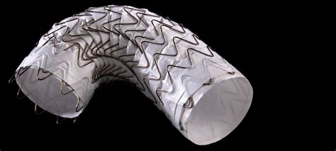 Gore Receives Fda Approval For Gore Tag Conformable Thoracic Stent