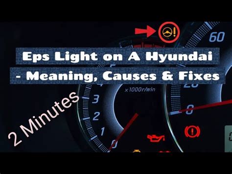 Eps Warning Light Hyundai Elantra Shelly Lighting