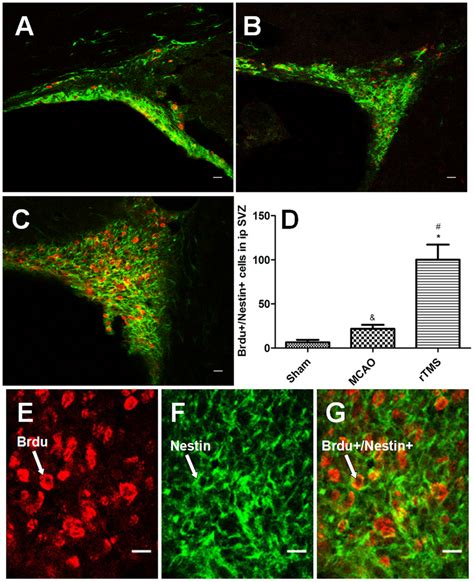 Confocal Image Of Brdu Red And Nestin Green Co Immunofluorescence